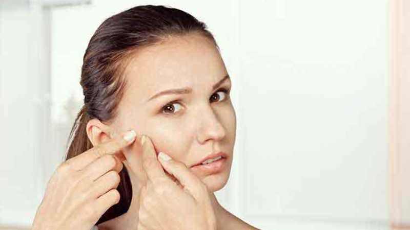 Homeopathic Acne Treatment – Can You Eradicate Acne With It?