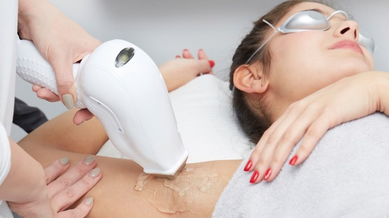 All About Laser Hair Removal