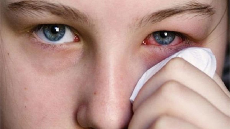 Pink Eye Symptoms And Your Health
